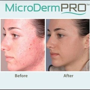 Buy 1 Get 1 FREE! Exfoliation & Microdermabrasion MicroDerm360 PRO NIB